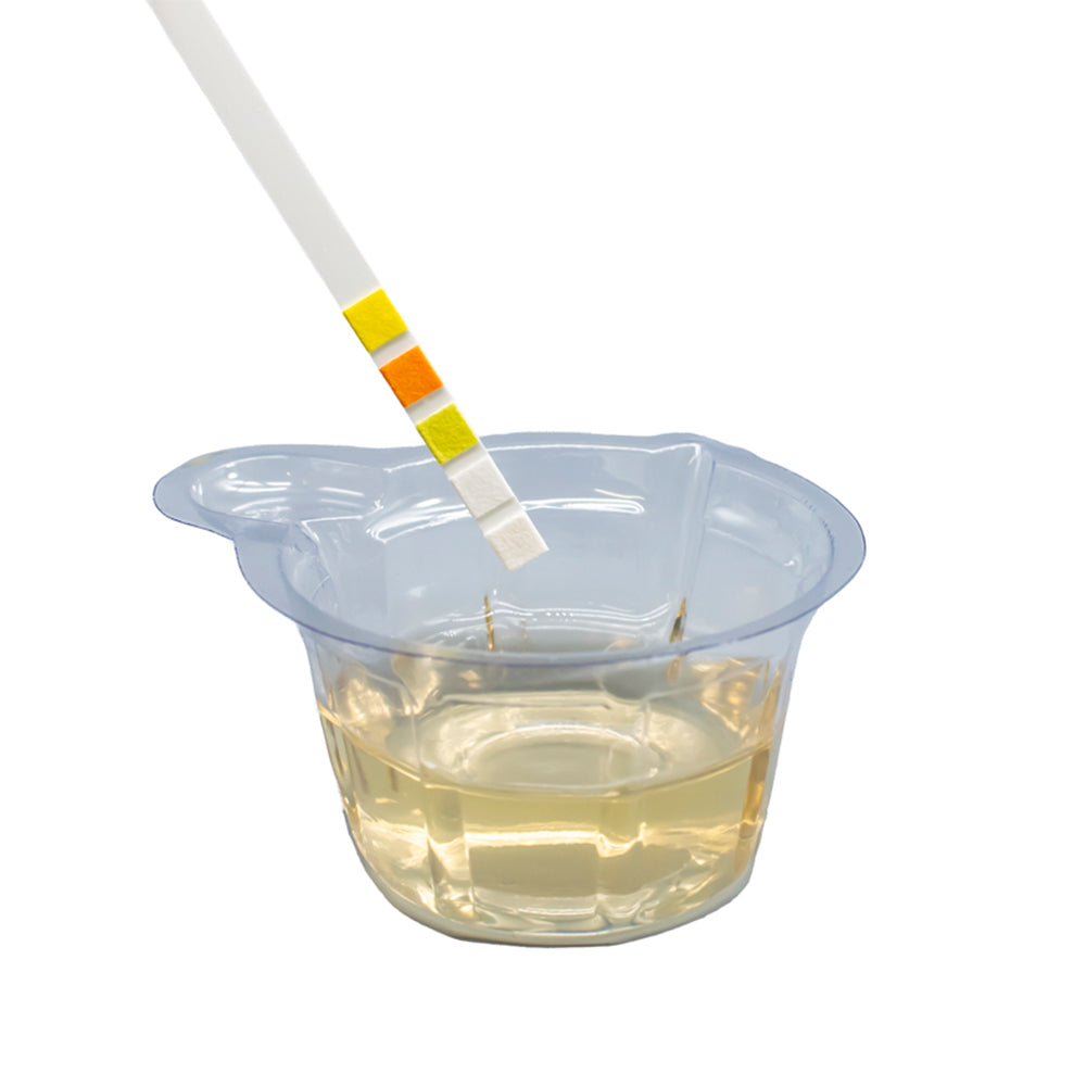 Test Rapide – Gobelets de Prélèvement d’Urine (50 unités)